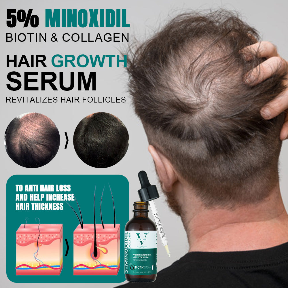 Vielor hair growth serum (5% minoxidil & biotin)