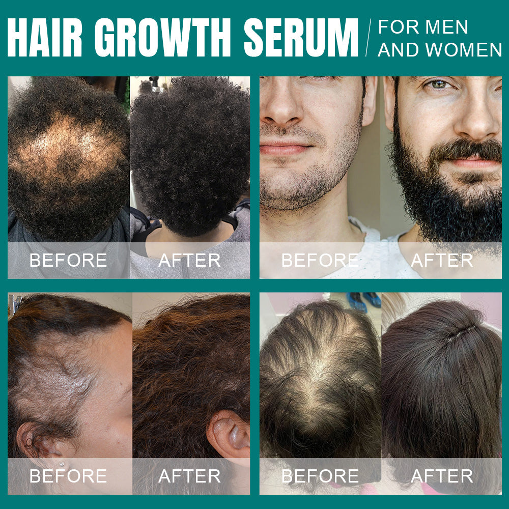 Vielor hair growth serum (5% minoxidil & biotin)