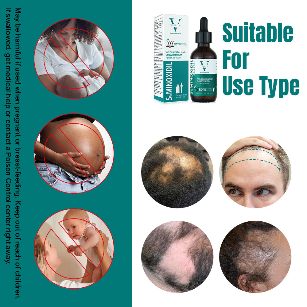 Vielor hair growth serum (5% minoxidil & biotin)