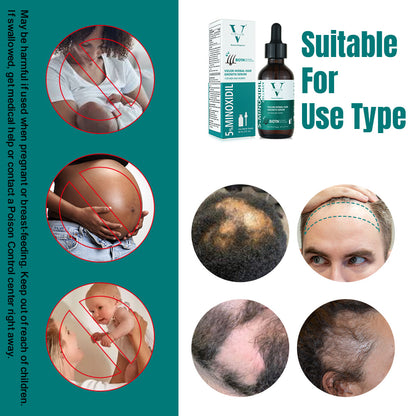 Vielor hair growth serum (5% minoxidil & biotin)